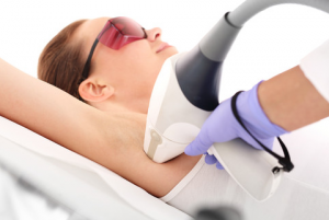 depilación laser